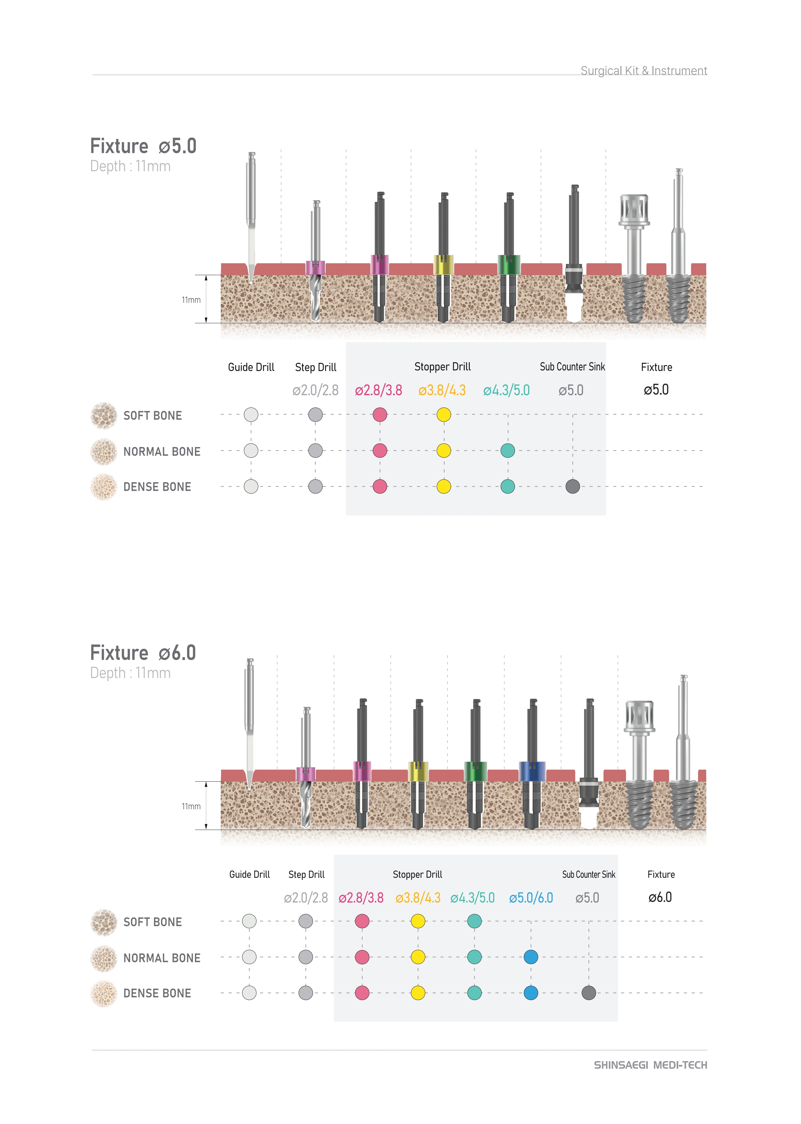 prosthesis