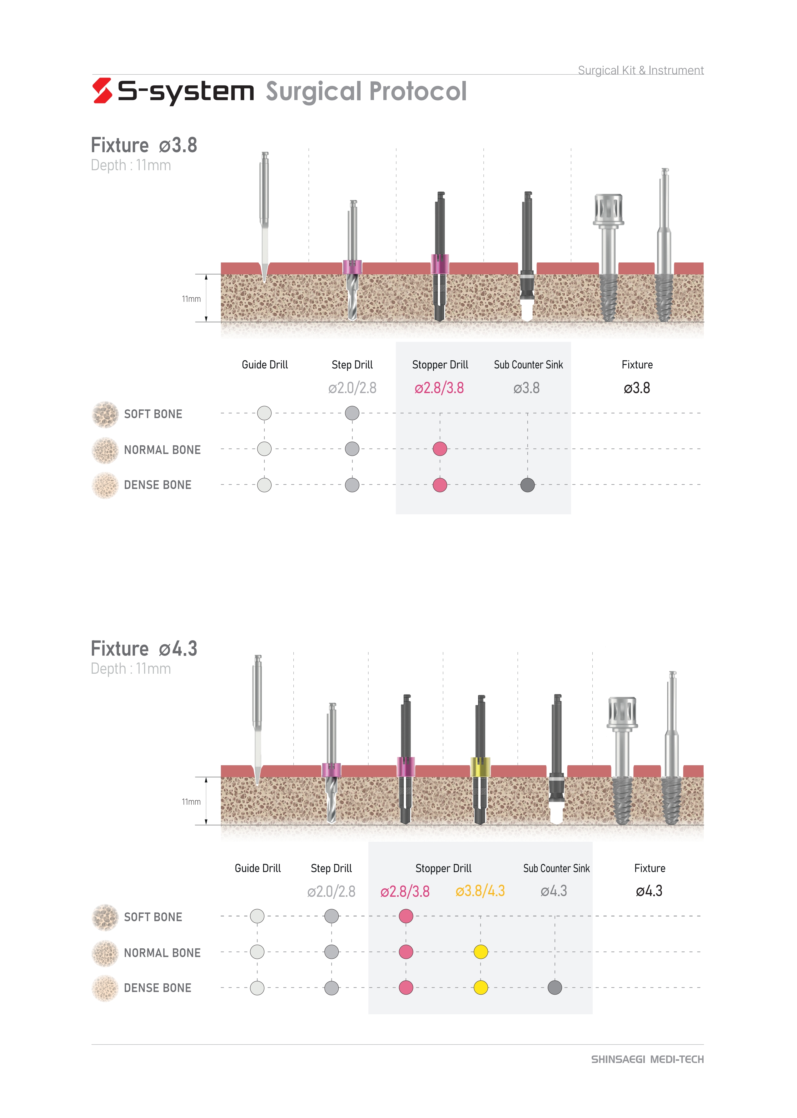 prosthesis